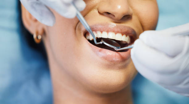 Best Teeth Whitening  in Masury, OH