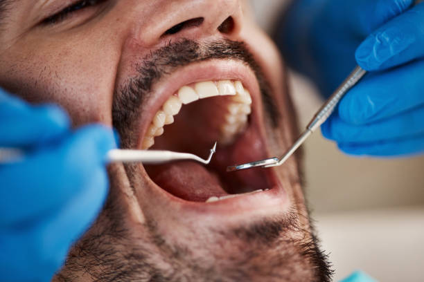 Best Broken Tooth Emergency  in Masury, OH