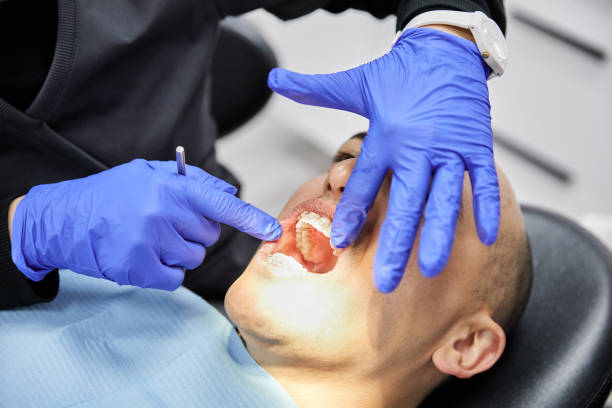 Best Knocked-Out Tooth Emergency  in Masury, OH